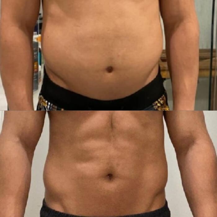 weight-loss-2