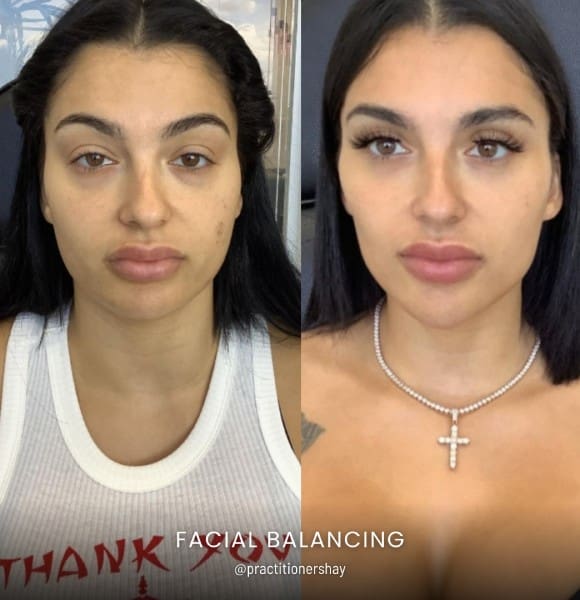 Facial Balancing treatment for women