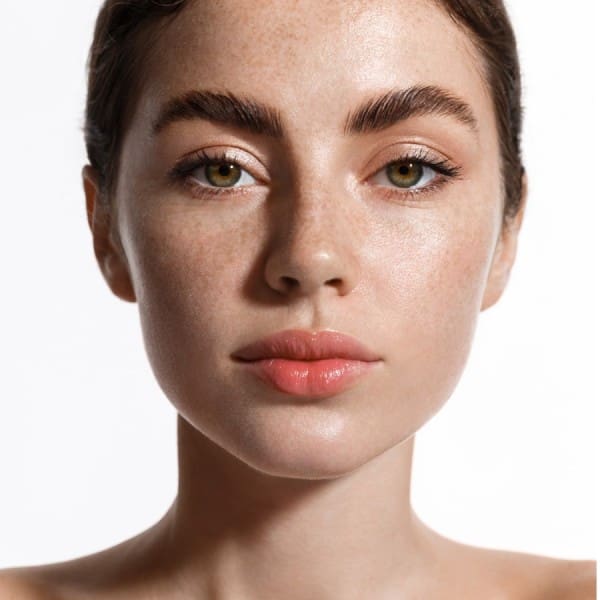 Masseter Botox in Miami and Boca Raton