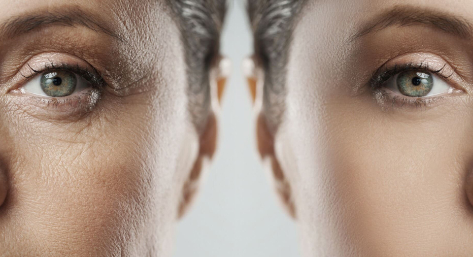 Preventative Botox: The Proactive Approach to Anti-Aging