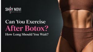 can-you-exercise-after-botox