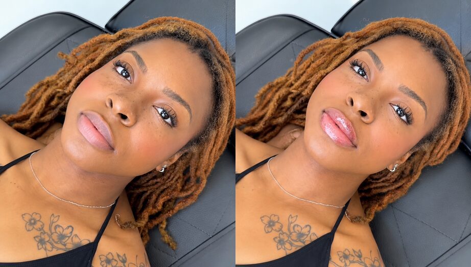 Lip Filler Aftercare: What to Avoid for Best Results