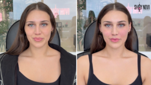 what-makes-facial-balancing-look-natural